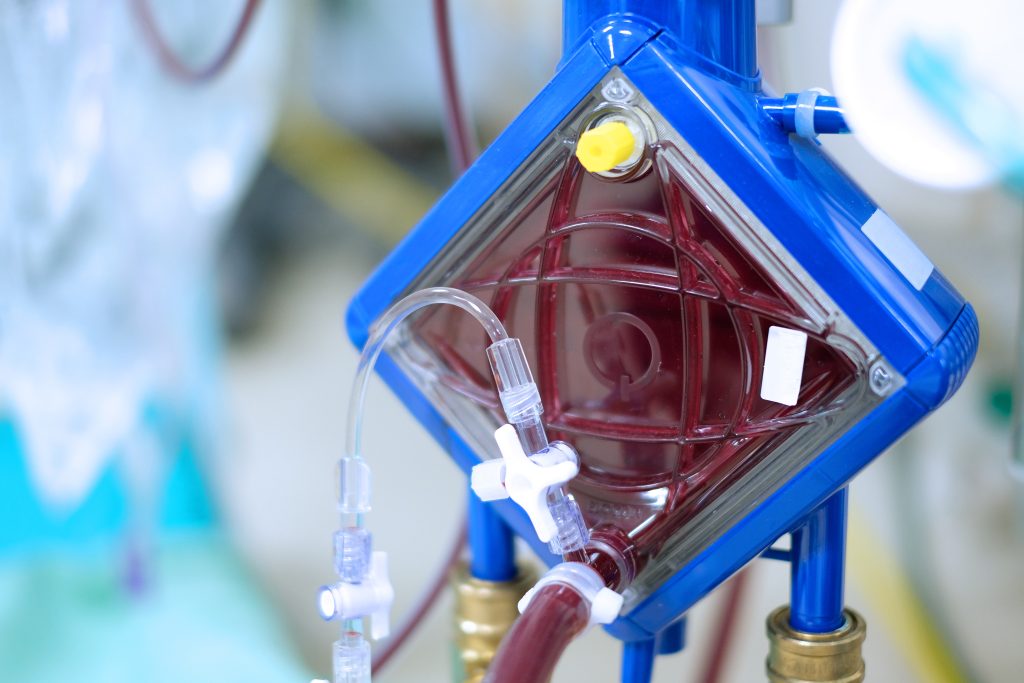 ECMO – Oxigenação por Membrana Extracorpórea
