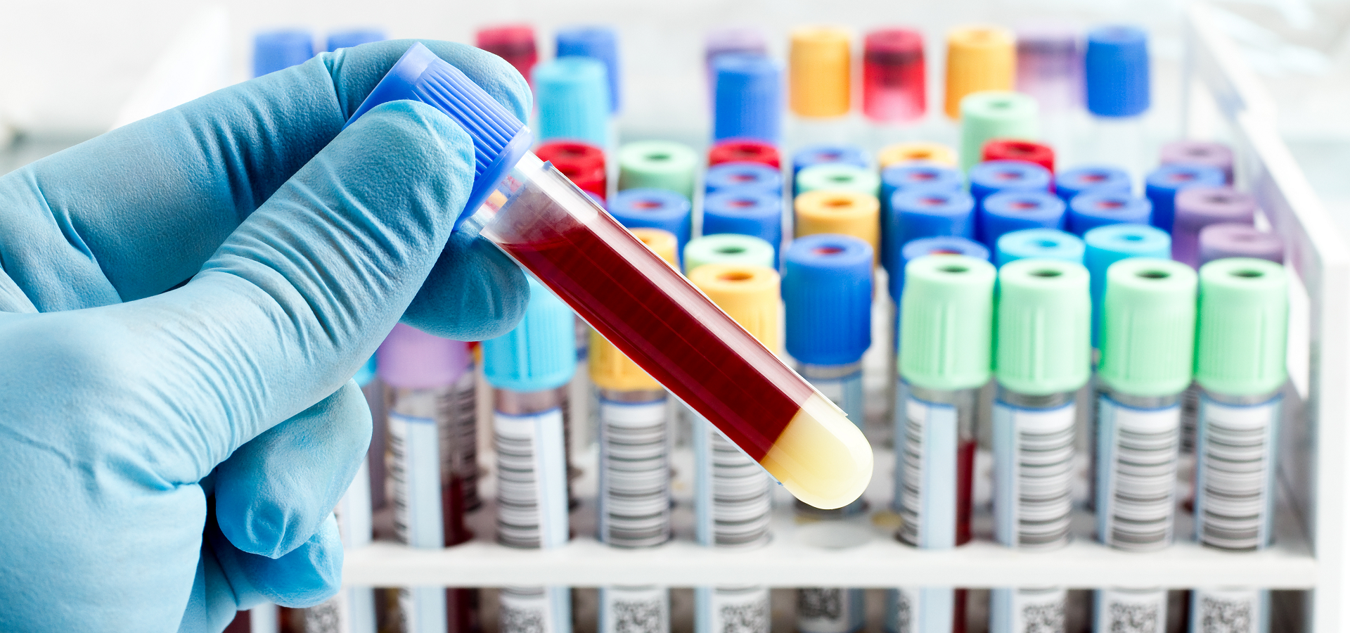Coleta de Sangue e Venopunção_correto