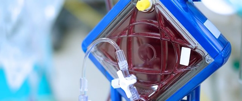 ecmo_img